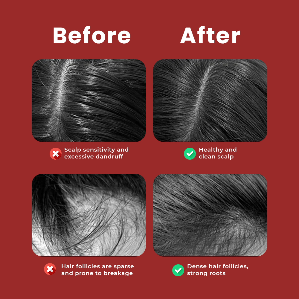 5-in-1 RedTech Comb